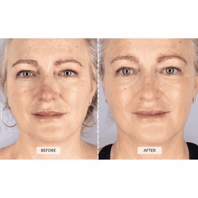 CurrentBody Skin Face & Neck Kit (worth 668€) - Black Friday Offer