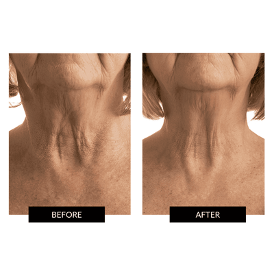CurrentBody Skin Face & Neck Kit (worth 668€) - Black Friday Offer