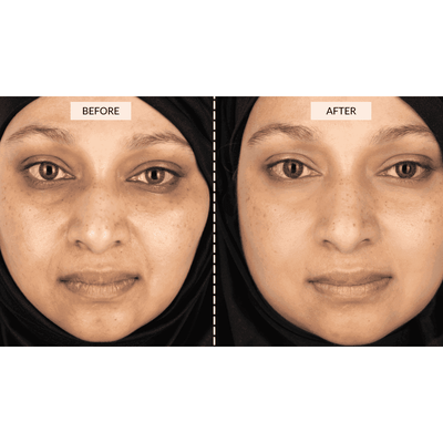 CurrentBody Skin Face & Neck Kit (worth 668€) - Black Friday Offer